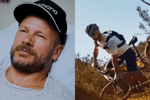 Abscesso após queda: especialistas explicam os riscos em acidente de Rodrigo Hilbert