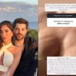Romana Novais mostra “ondulações” nos seios após complicações com prótese de silicone