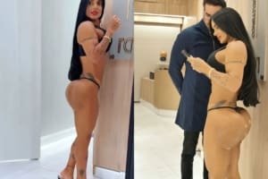 Kamila Simioni passa por procedimento para reparar danos causados por hidrogel no bumbum
