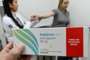 Brasil recebe mais de 100 mil implantes contraceptivos Implanon