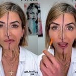 Quem sabe faz ao vivo! Médica aplica Botox no próprio rosto e surpreende internautas