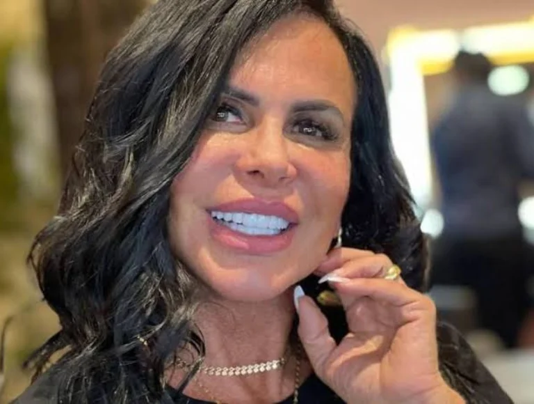 Veja o antes e depois do tratamento de Gretchen contra alopecia
