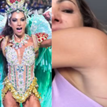 Patrícia Poeta mostra ferimentos após desfile como musa da Grande Rio. Veja!