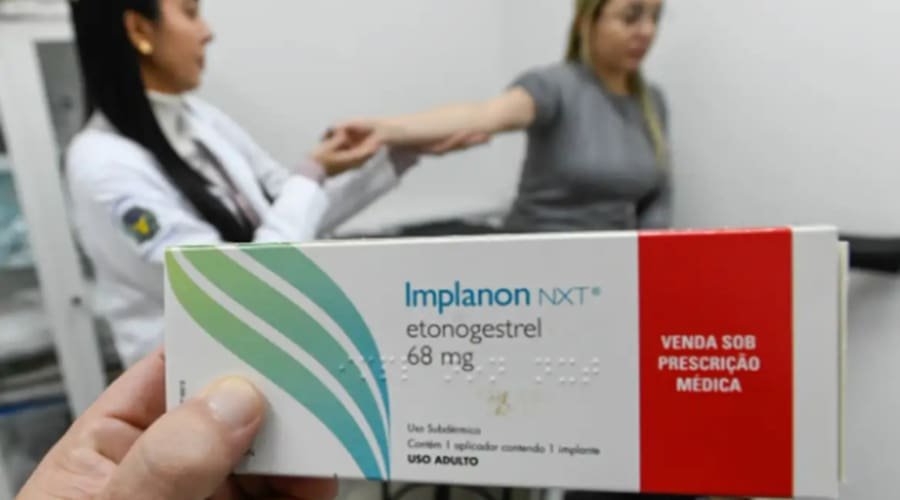 Implante contraceptivo deve ser ofertado por planos a partir de hoje