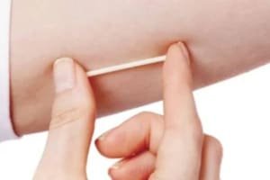 Implante contraceptivo hormonal será oferecido pelo SUS