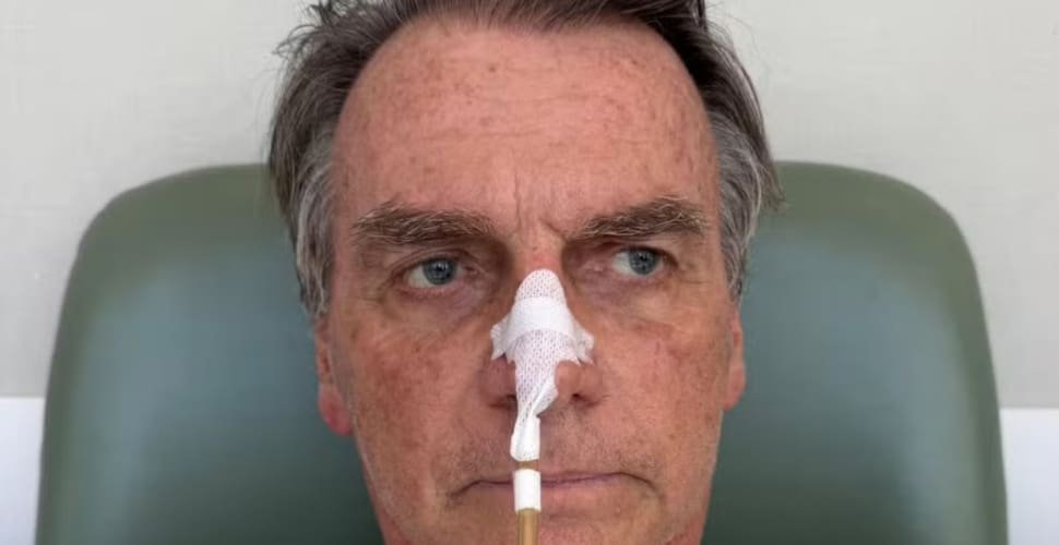 Bolsonaro retira sonda nasogástrica e avança em recuperação da cirurgia abdominal