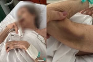 Morre mãe abandonada por filho advogado em unidade de saúde em estado gravíssimo