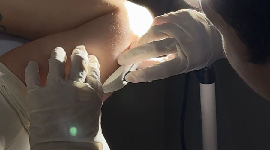 Aparecida passa a oferecer implante contraceptivo Implanon