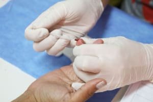 Prefeitura de Aparecida promove Campanha de Carnaval para prevenir infecções sexualmente transmissíveis