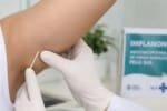 Anvisa amplia para cinco anos validade do implante contraceptivo